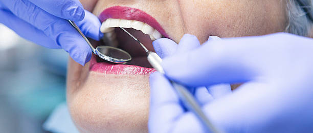 Teeth Whitening in NJ